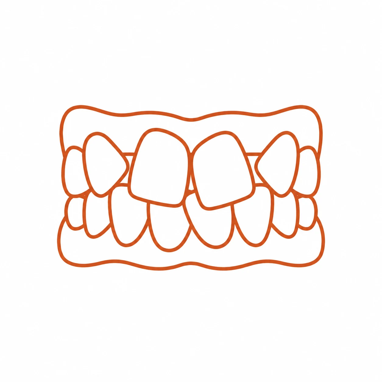 Crossbite bite illustration