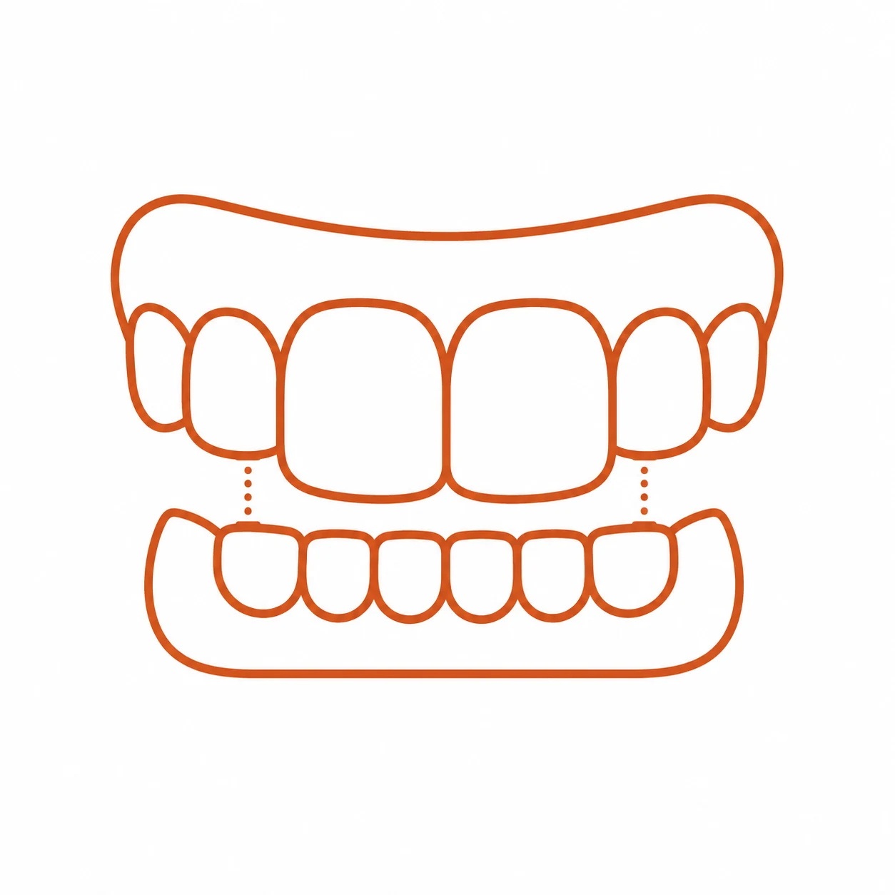 Crowding bite illustration