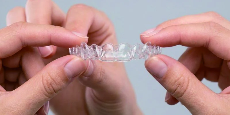 Insert aligners step 1