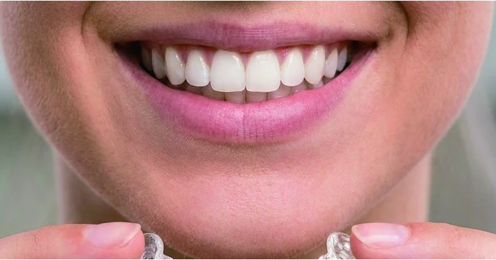 Remove aligners step 3